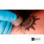 YouTube видео How Laser Tattoo Removal Works - Smarter Every Day 123. #day