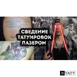 УДАЛЕНИЕ ТАТУИРОВКИ ЛАЗЕРОМ | ВСЁ О ЛАЗЕРНОМ УДАЛЕНИИ